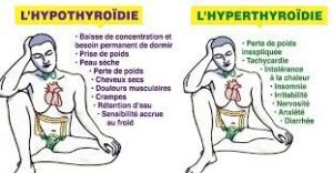 L'hyperthyroïdie