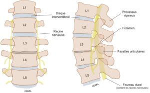 Discopathie dégénérative Solution Naturelle