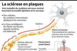 Sclérose en Plaques Solution Naturelle