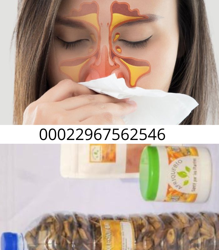 Solution naturelle pour traiter la sinusite